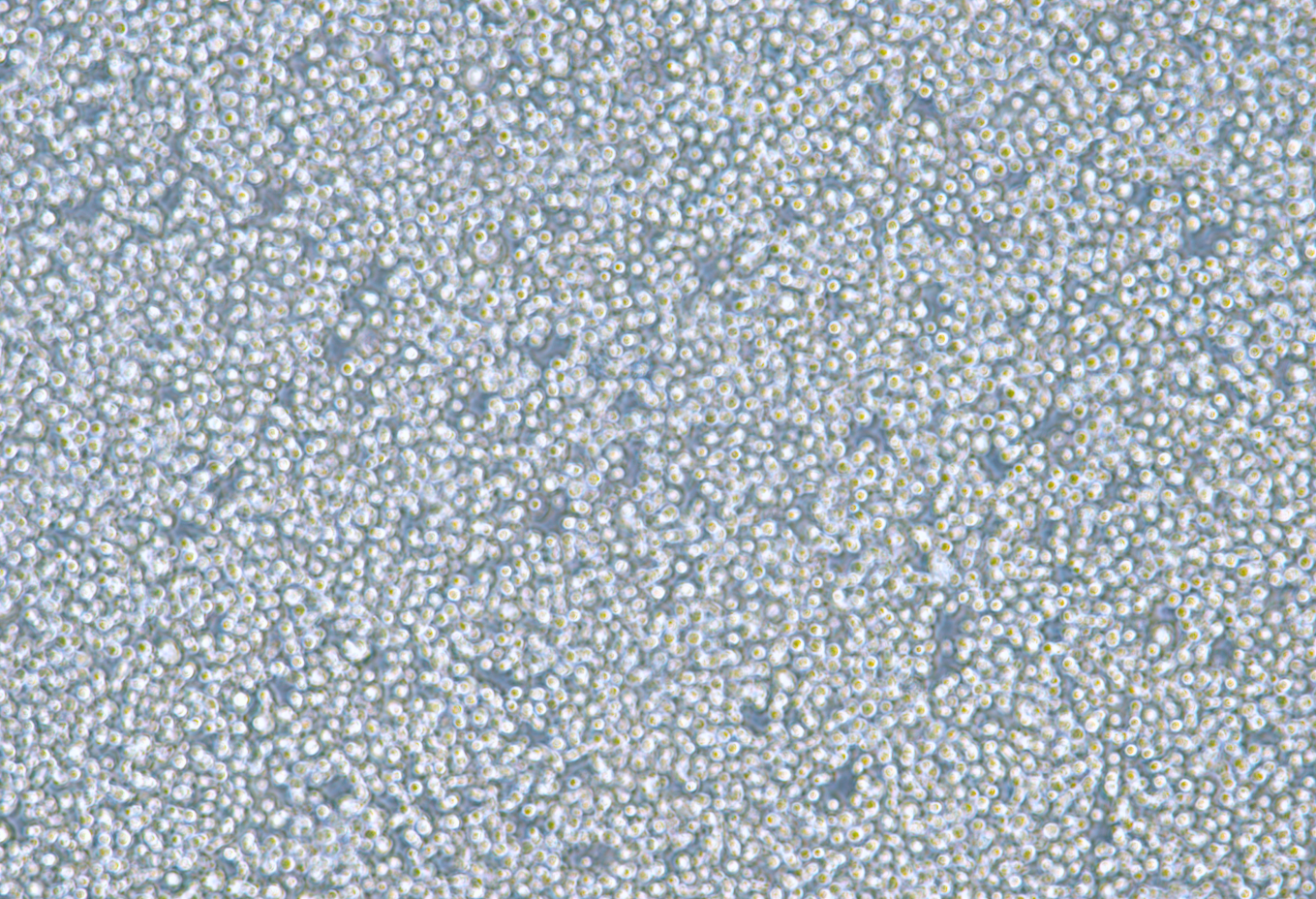 人骨髓瘤细胞NCI-H929(STR鉴定正确)