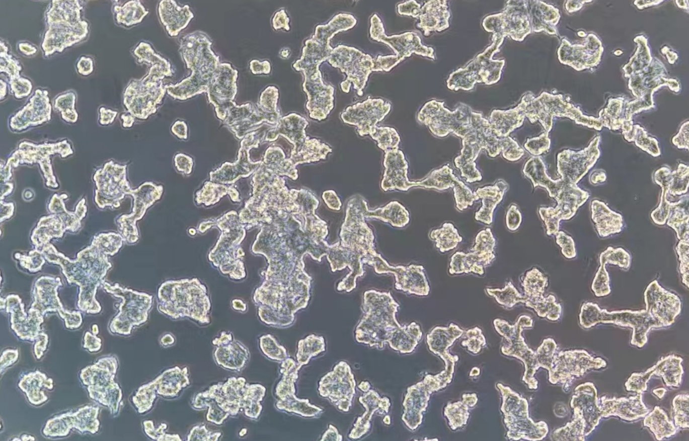 人乳腺导管癌细胞 ZR-75-1(STR鉴定正确)