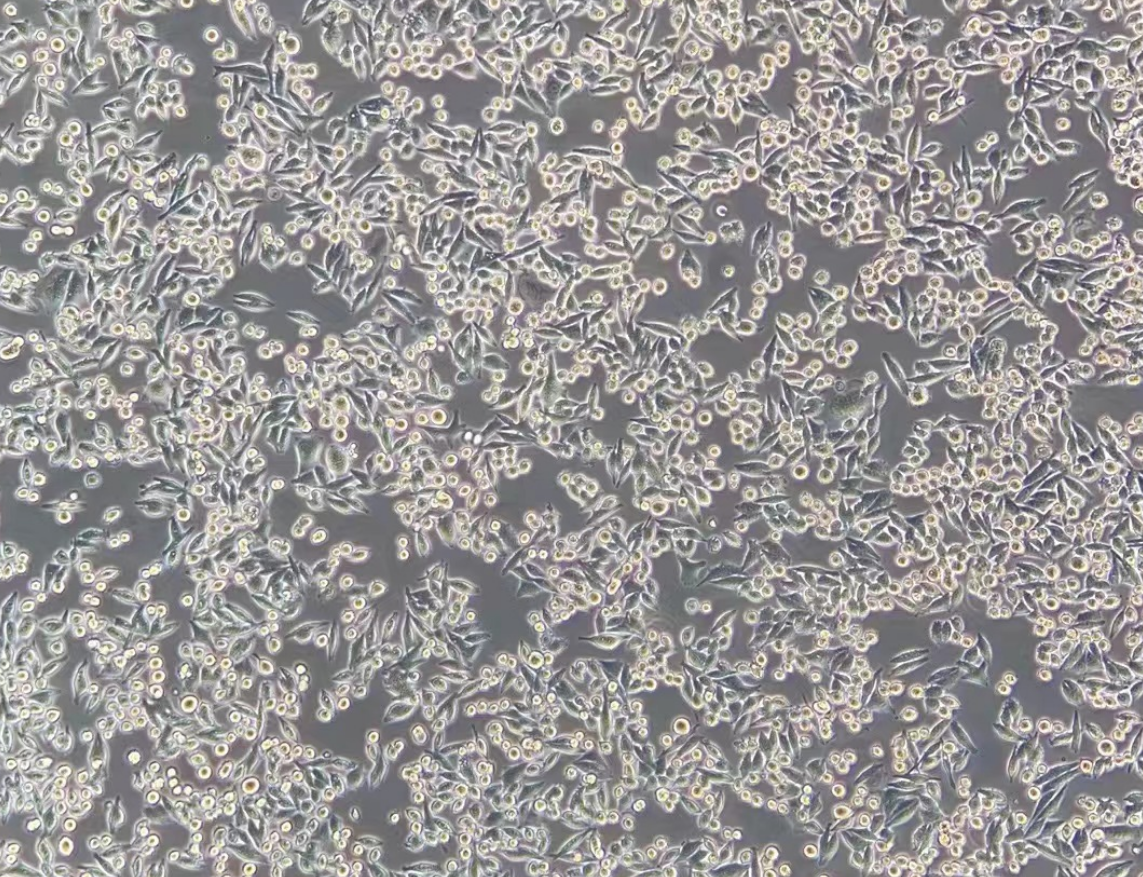 人结肠癌细胞SW480(STR鉴定正确)