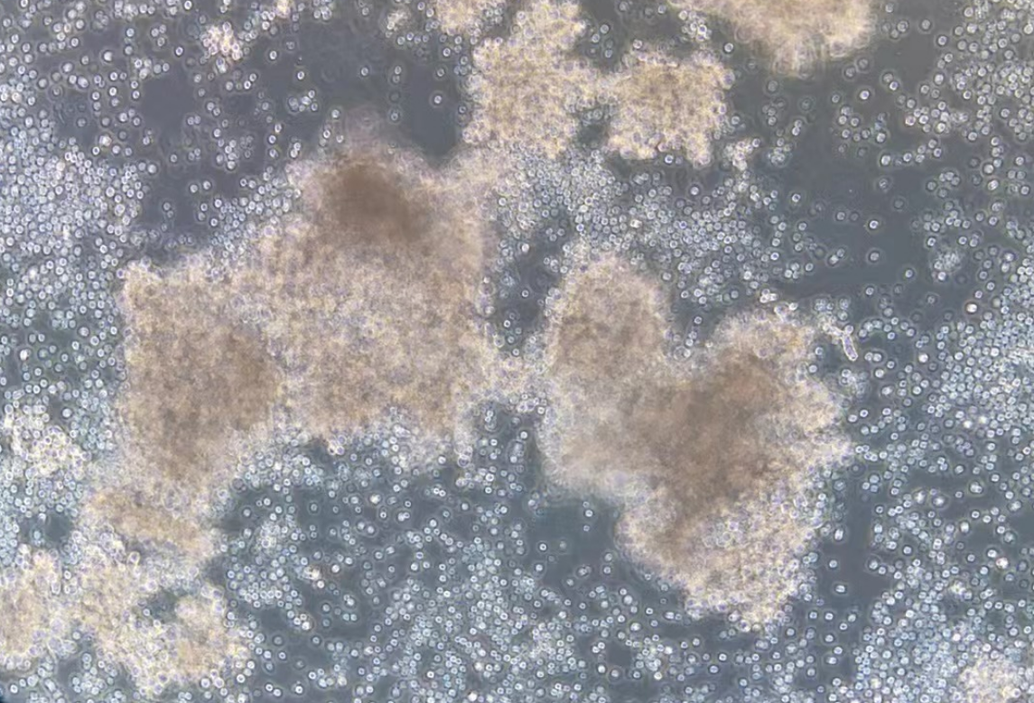 人小细胞肺癌细胞NCI-H209(STR鉴定正确)
