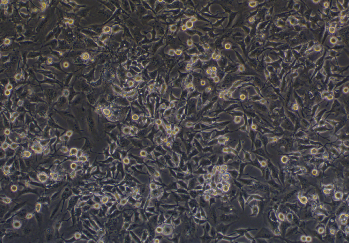 人乳腺癌细胞MDA-MB-436(STR鉴定正确)