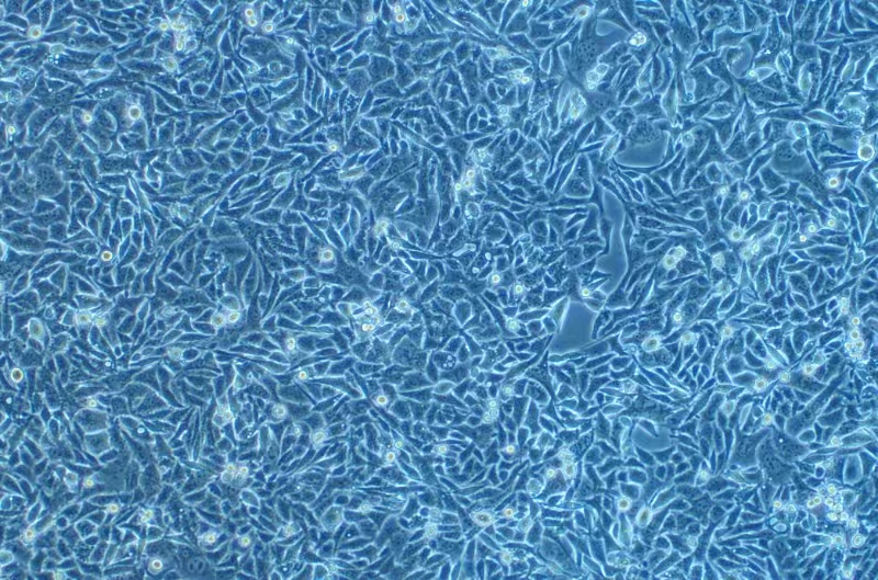 小鼠恶性乳腺癌细胞PY8119+GFP 