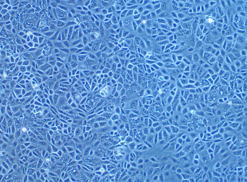 人乳腺癌细胞CAL-51(STR鉴定正确)