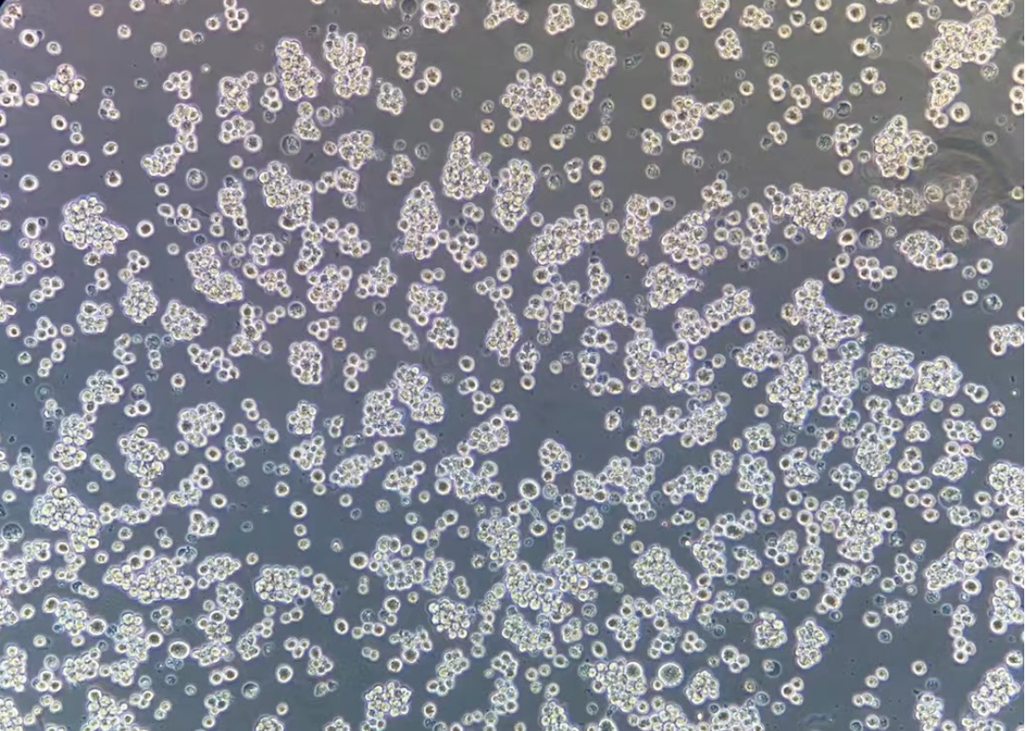 人霍奇金淋巴瘤HDLM-2