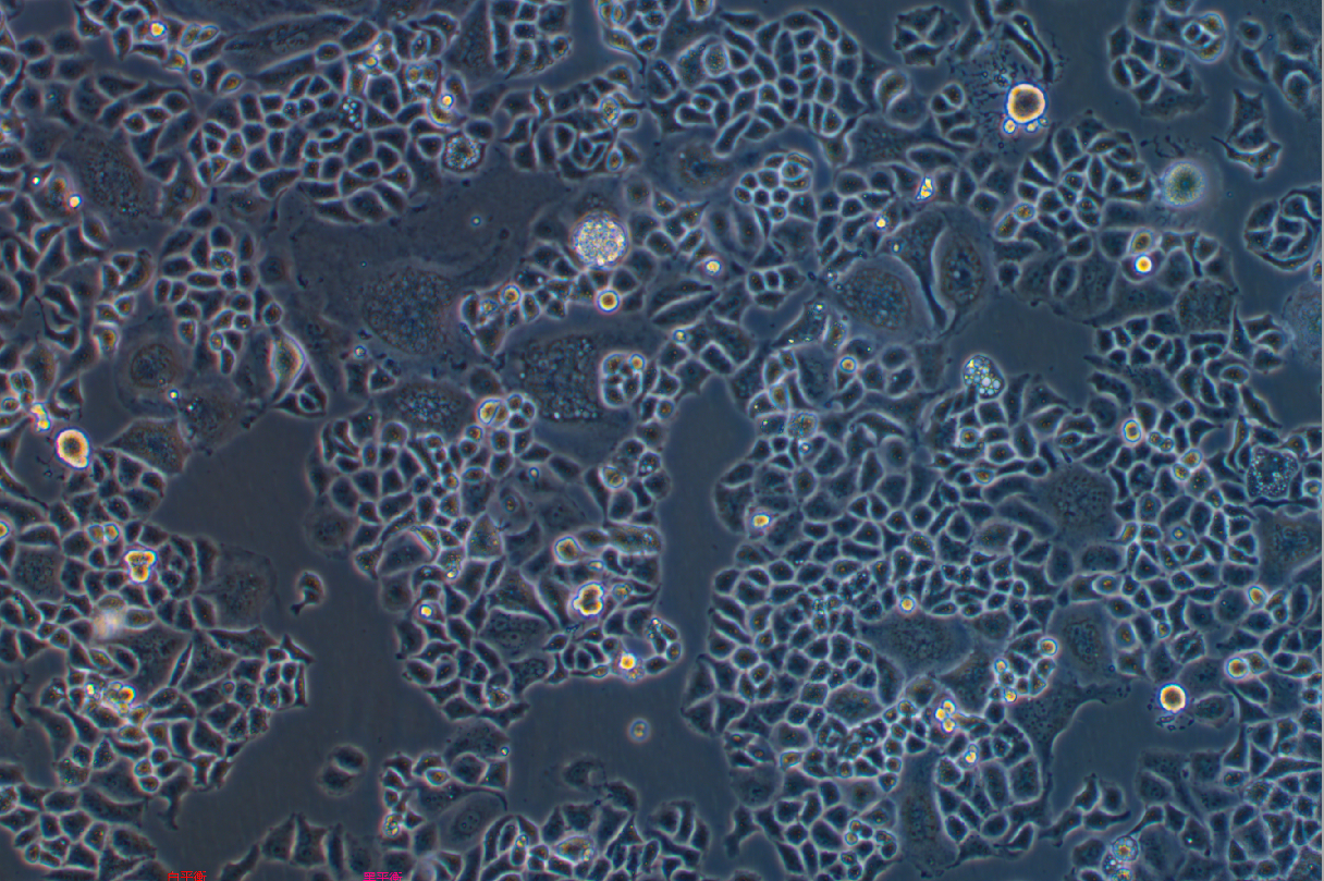人宫颈癌细胞顺铂耐药株C33A+DDP