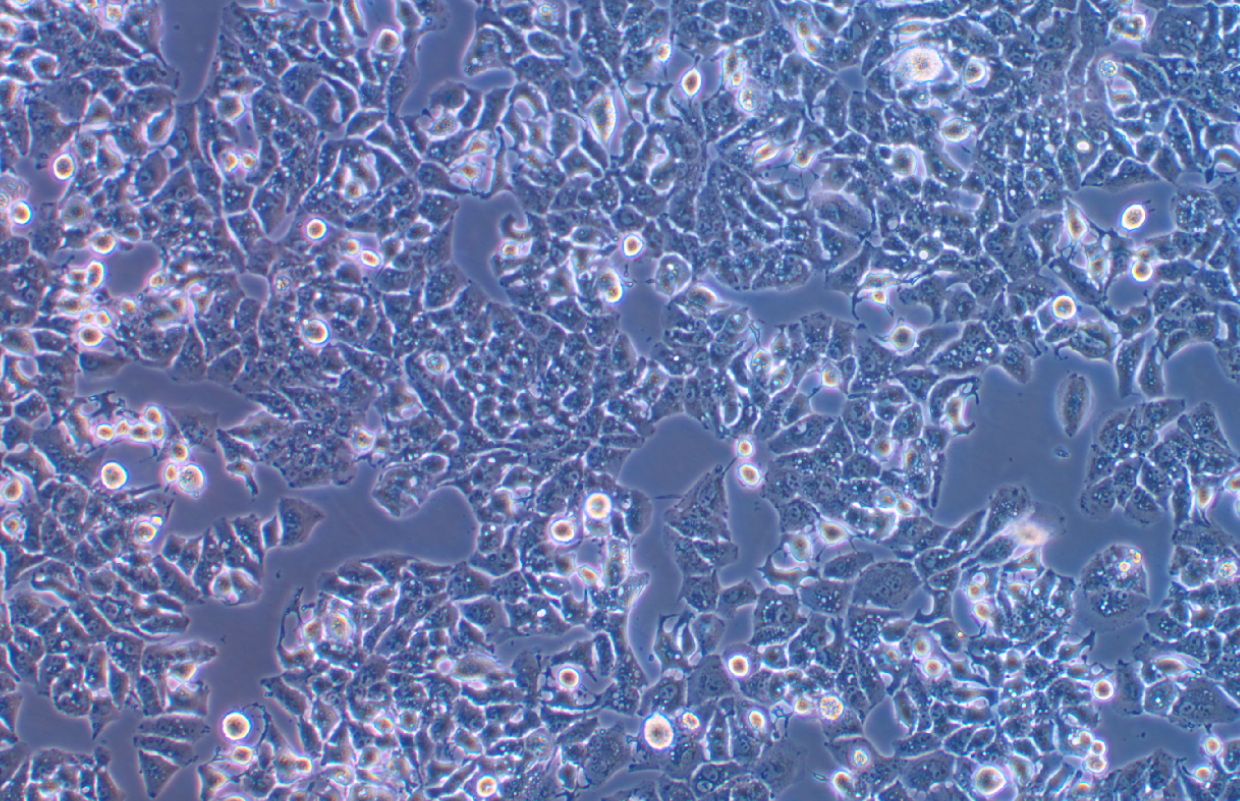 低转移人肝癌细胞MHCC97-L(STR鉴定正确)