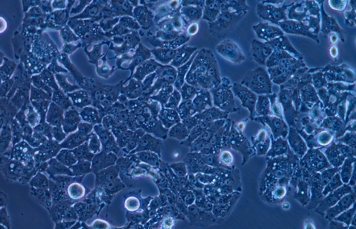 低转移人肝癌细胞MHCC97-L(STR鉴定正确)
