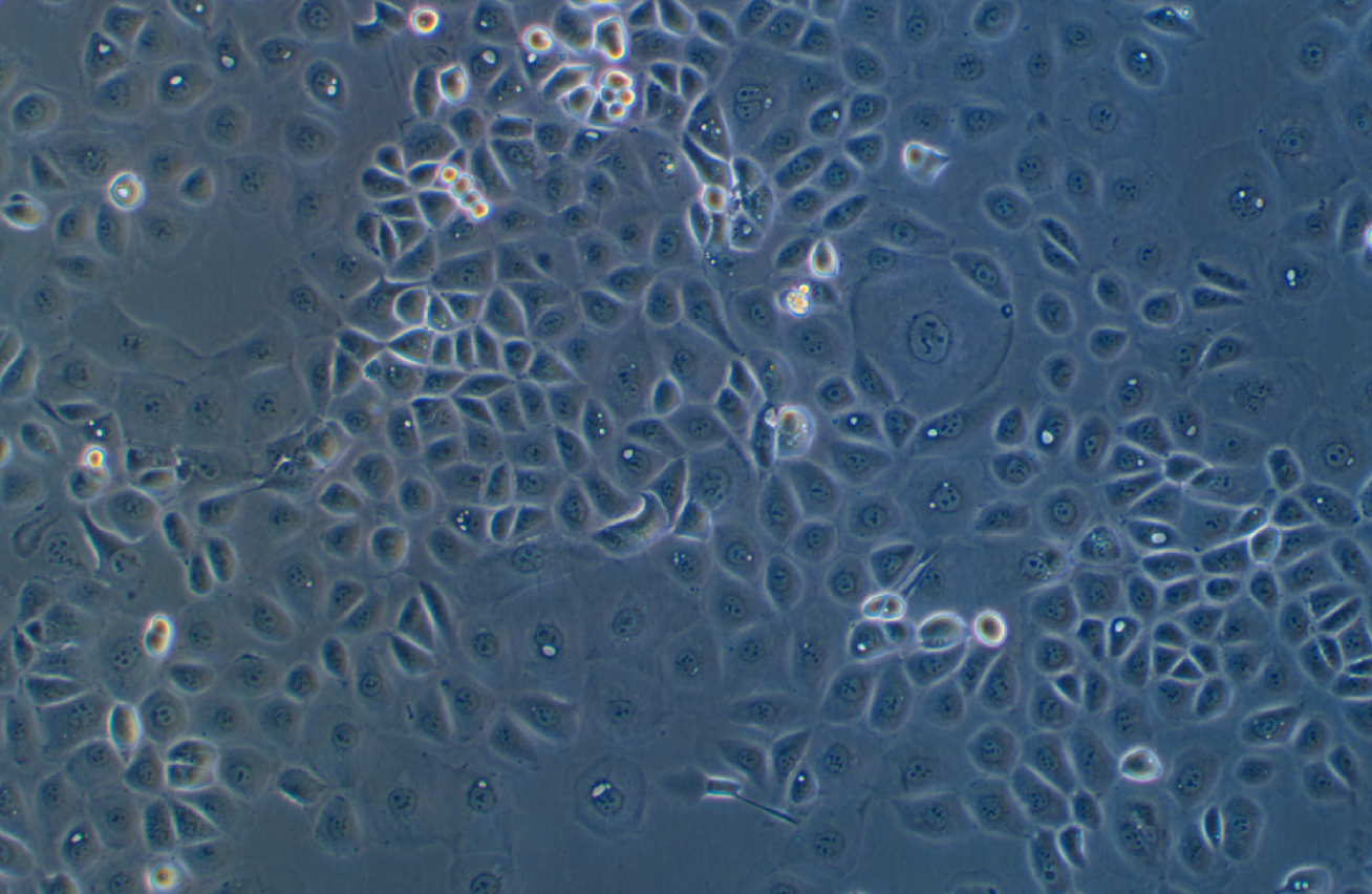 人卵巢癌腺癌细胞NIH:OVCAR-3(STR鉴定正确)