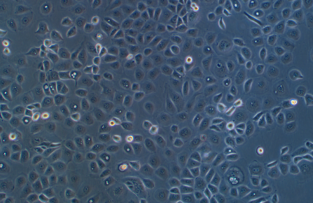 人卵巢癌腺癌细胞NIH:OVCAR-3(STR鉴定正确)