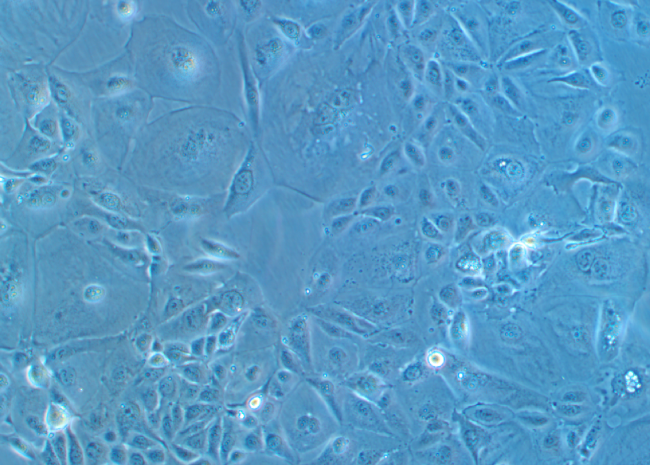 人肺腺癌细胞NCI-H3255(STR鉴定正确)