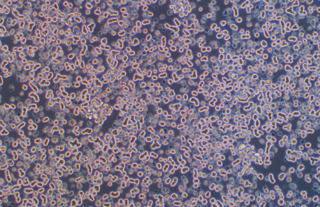 人乳腺上皮细胞DU4475(STR鉴定正确)