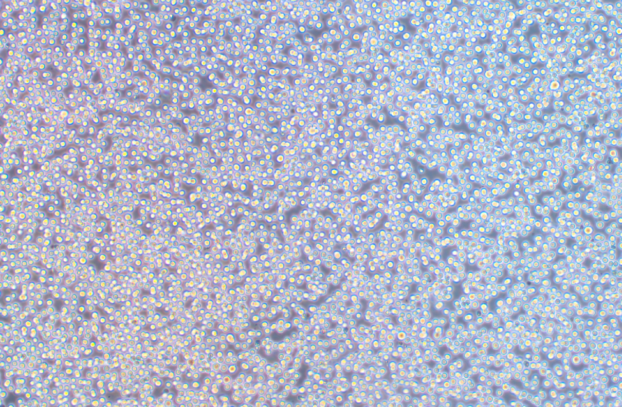 人套细胞淋巴瘤细胞REC-1 (STR鉴定正确)